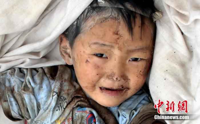 2008年5月14日，在汶川地震中受伤的儿童。/p中新社记者 邹宪 摄