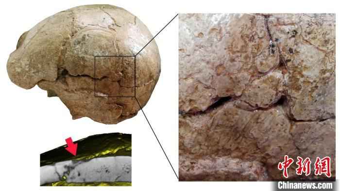 和县直立人头盖骨表面的裂痕(吴秀杰 供图)