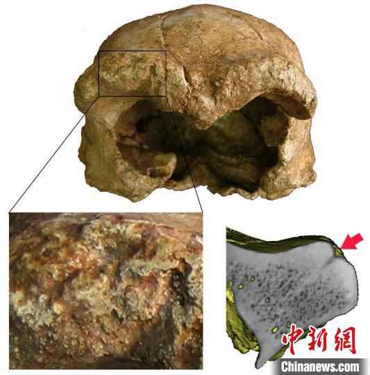 和县直立人眶上圆枕部环境侵蚀痕迹。(吴秀杰 供图)