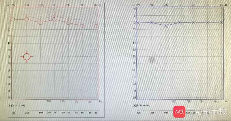 太紧张、太疲劳可导致突发性耳聋 3天内及时就诊可治愈